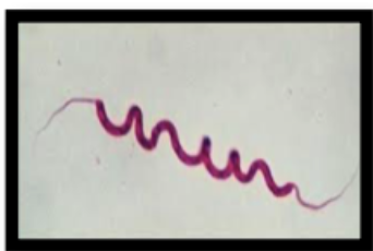<p><span style="background-color: transparent;"><strong><span>Describe each arrangement of flagella: Amphitrichous: </span></strong></span></p>