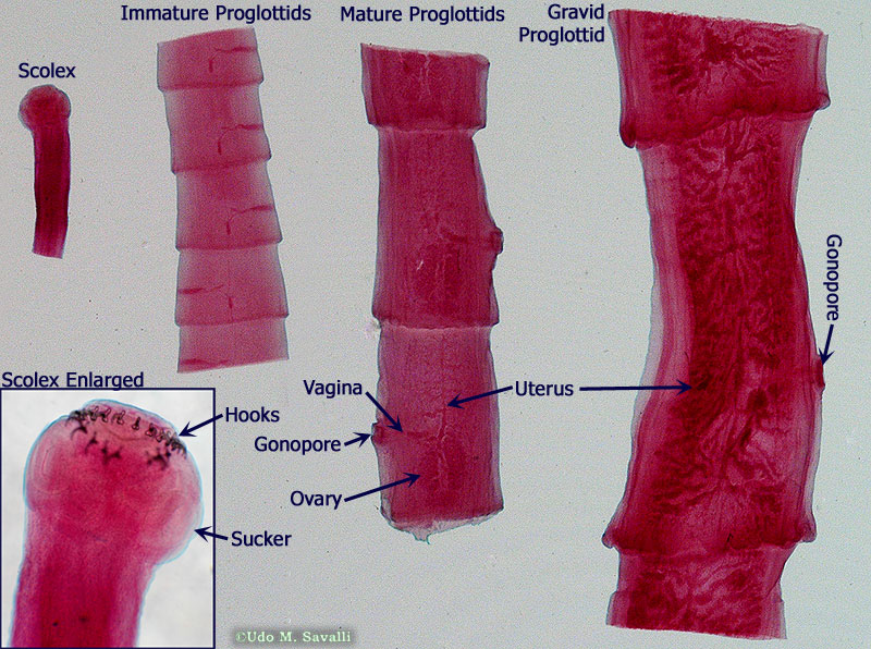 <p>1.) Platyhelminthes</p><p>2.) Cestoda</p><p>3.) Mature proglottid segments infect cow/pig from contaminated vegetation. Humans eat contaminated muscle(larvae in muscle). Tapeworm grows to full maturity in human. Shedding of mature proglottid segments causes spread</p><p>4.) Monoecious</p><p>5.) Taemia solium (intermediate host: pig)</p><p>6.) Pig or cow</p><p>7.) Endoparasitic </p><p></p>