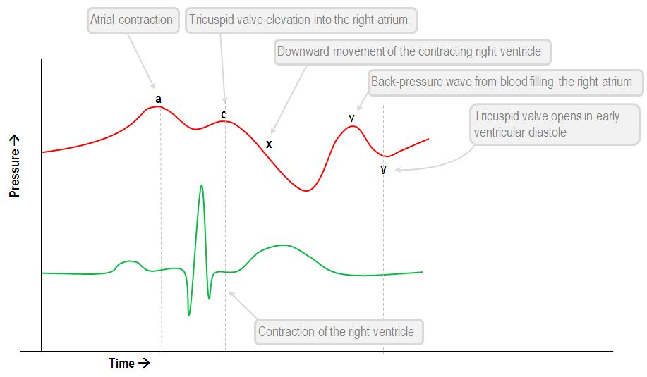 <p>A wave for pressure waveform</p><p>p wave for ECG</p>