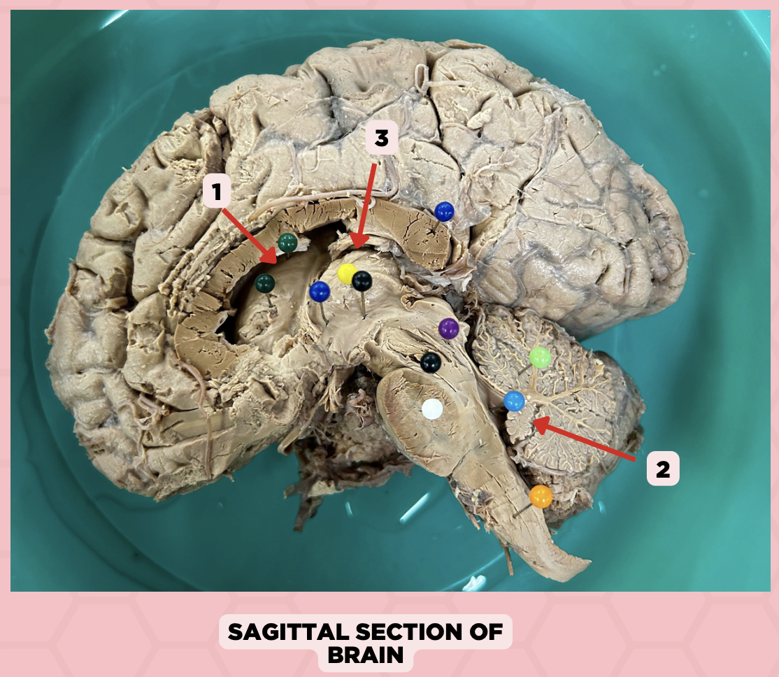 <p>Identify the structure labeled as 1.</p>
