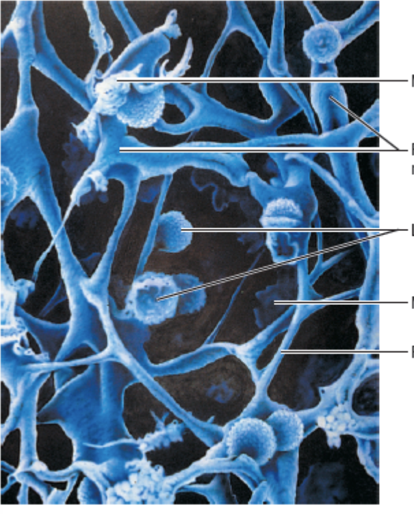 <p>Match the following term to its description: reticular cell</p>