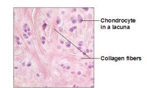 <ul><li><p>lacuna </p></li><li><p>chondrocyte→ clusters</p></li></ul><p></p>