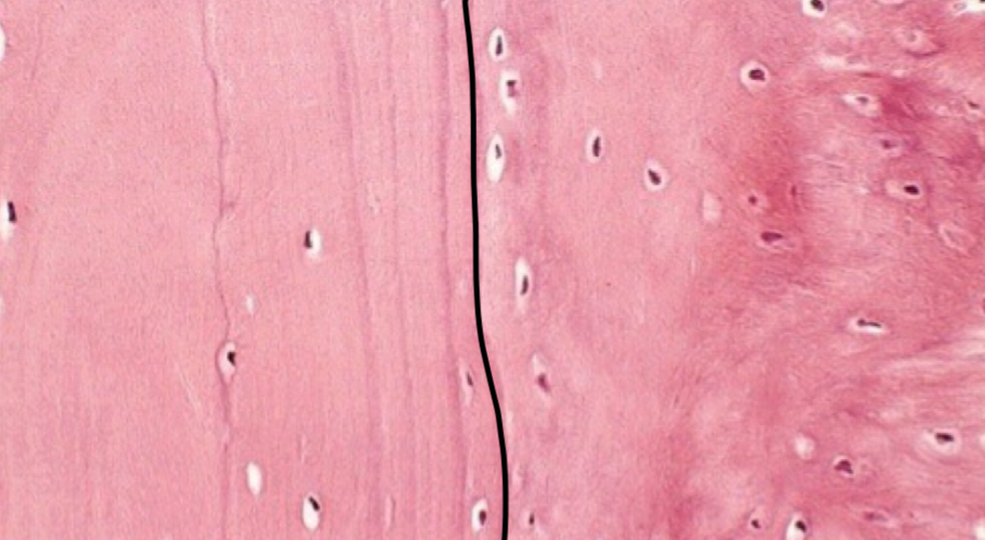 <p>what bone is depicted on the right</p>