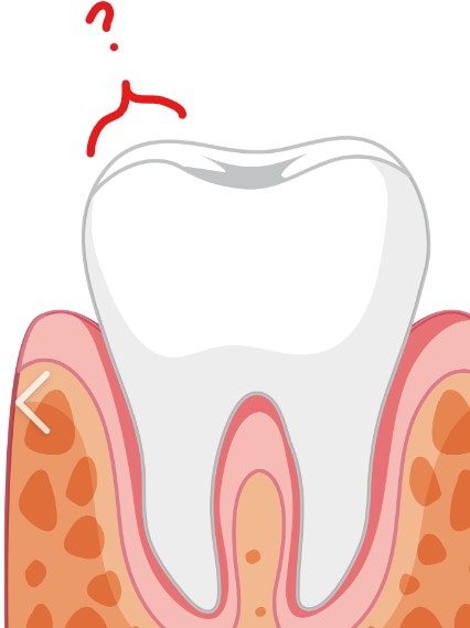 <p>Buccal view</p>