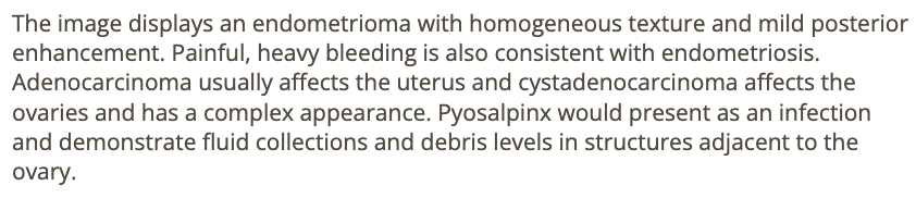 <p>b) endometrioma </p>