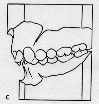 <p>Class II, Division II</p>