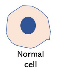 <p>Karyolysis </p>