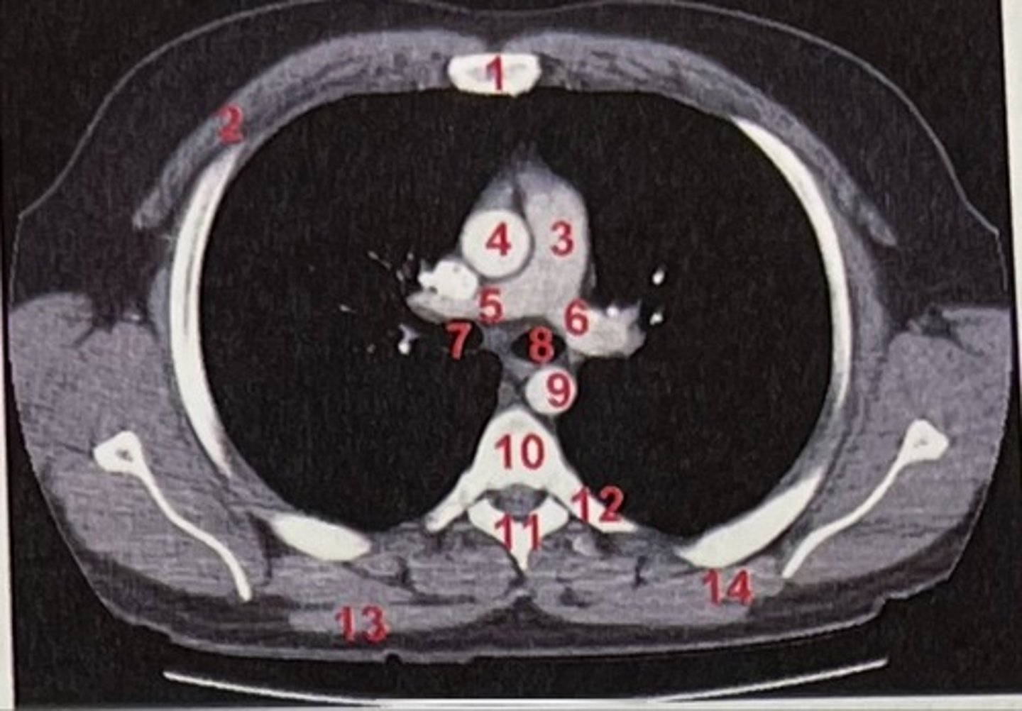 <p>What is 5 and 6</p>