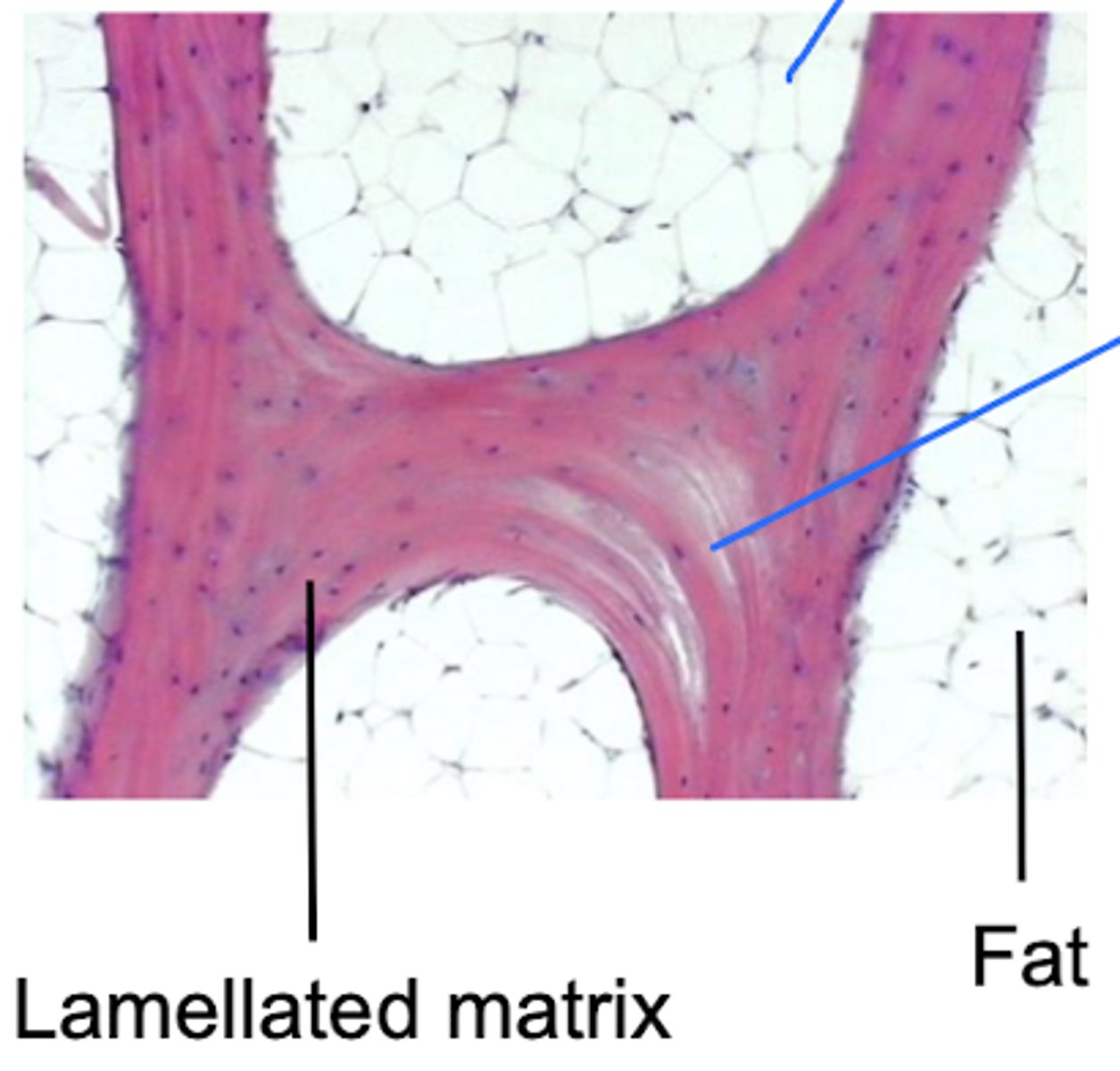 <p>What type of bone has a lamellated matrix?</p>