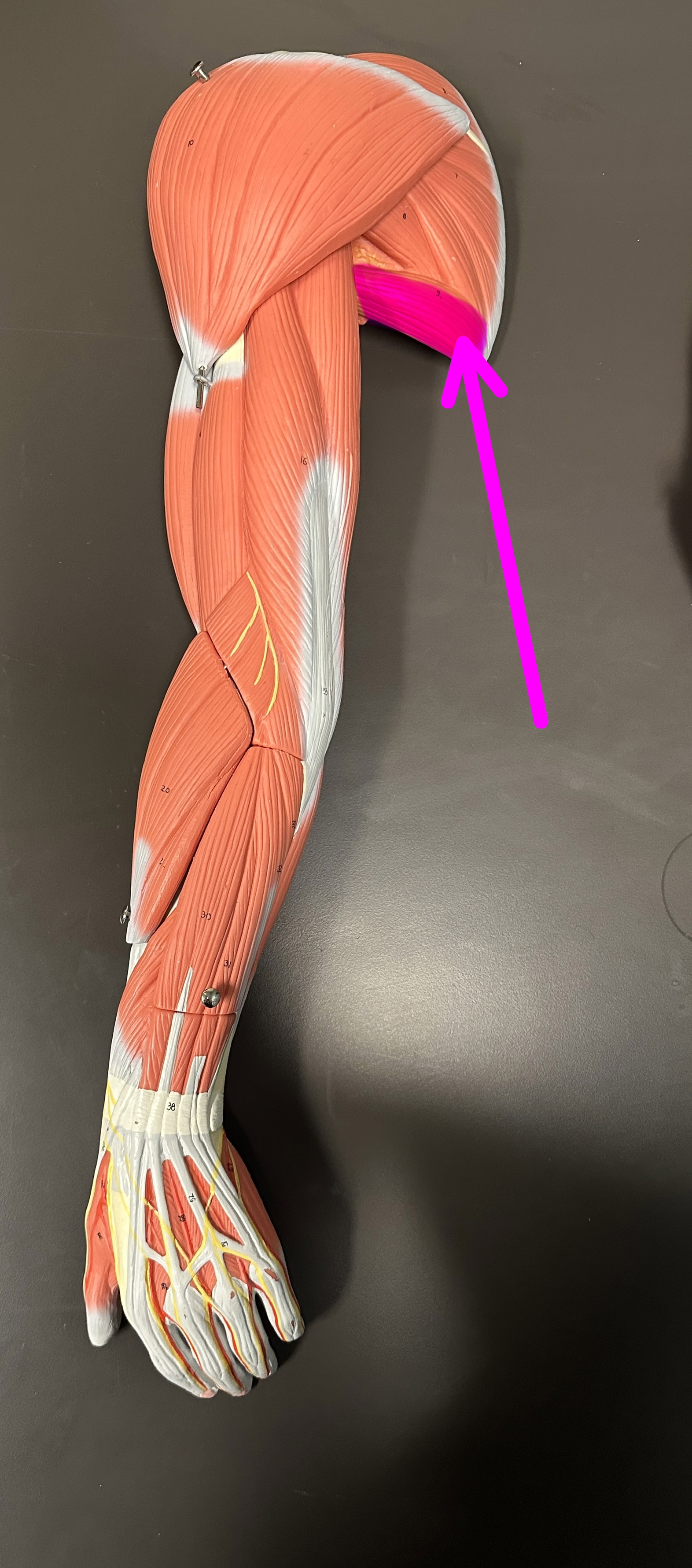 <p>What is the highlighted structure</p>