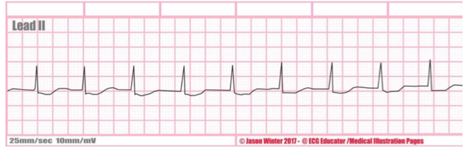 <p>what is this rate + characteristics?</p>
