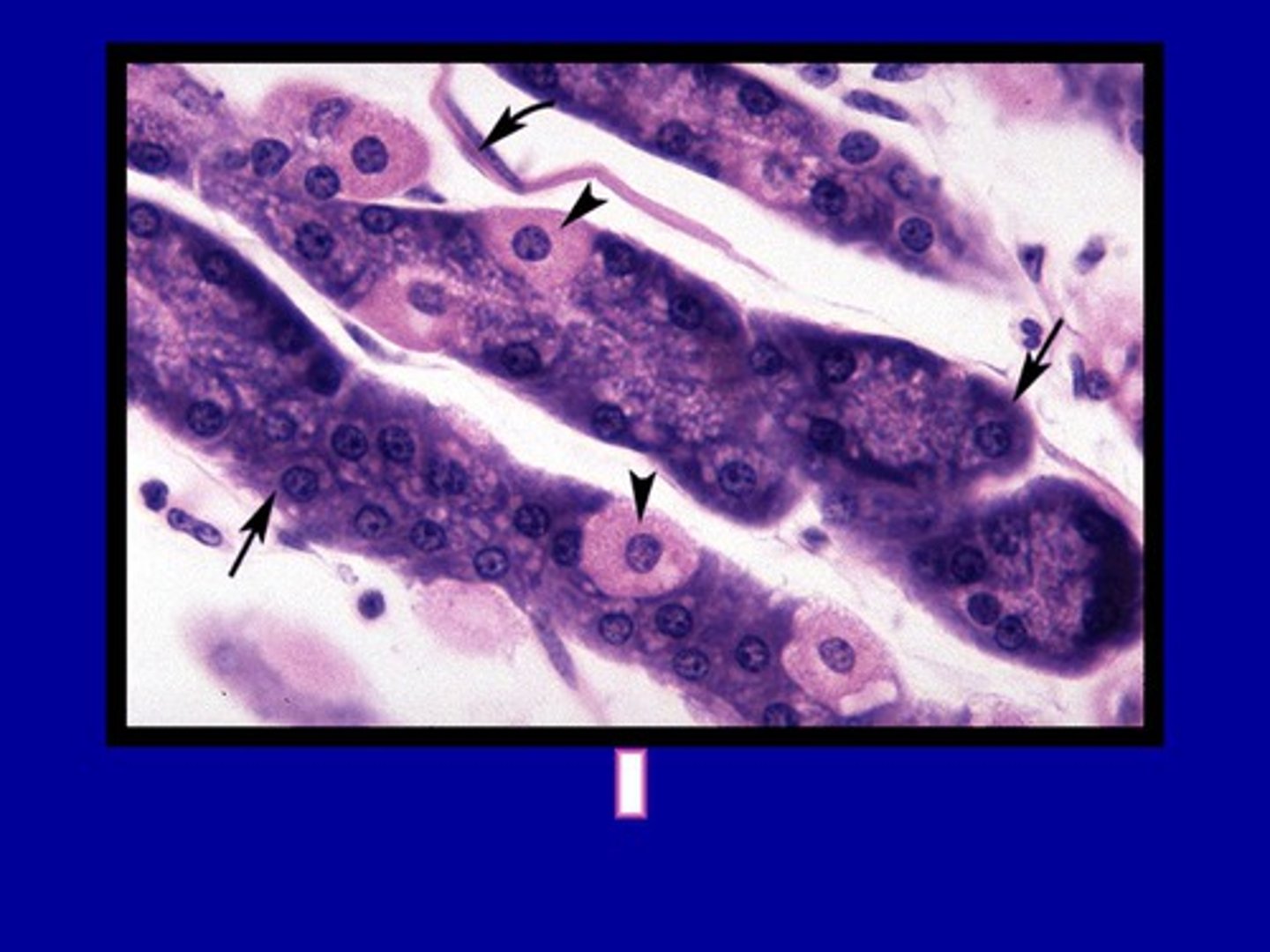 <p>What cells secrete acid &amp; IF in the fundus/body of stomach?</p>