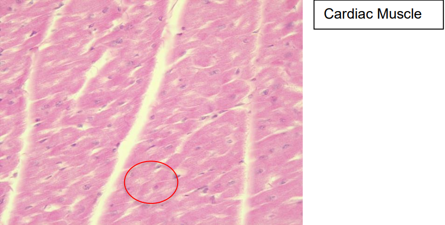 <p>Chacteristics: Branched patterns that striated</p><p>Function: Pumping blood and electrochemical signals</p><p>Location: Walls of the heart</p>