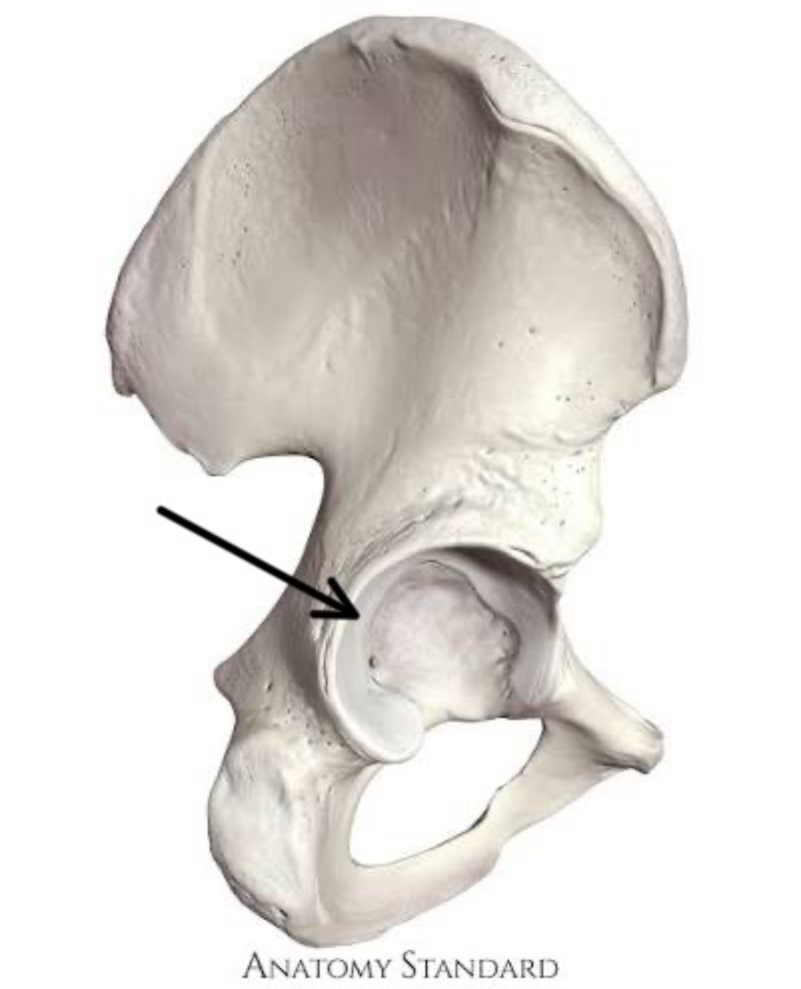 <p>what part of the coxal bone is this?</p>