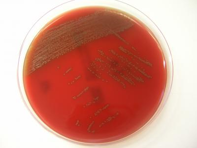 <p>What GPR has <strong>tiny alpha hemolytic</strong> colonies on SBA and is <strong>catalase -</strong>?</p>