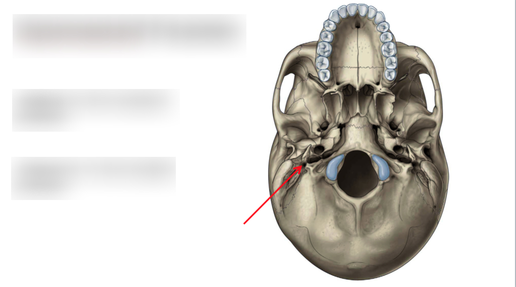 in temporal bone