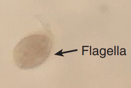 <p>Most encountered parasite in urine</p><ul><li><p>Pear-shaped flagellate</p></li><li><p>Rapid darting motility</p></li></ul><p></p>