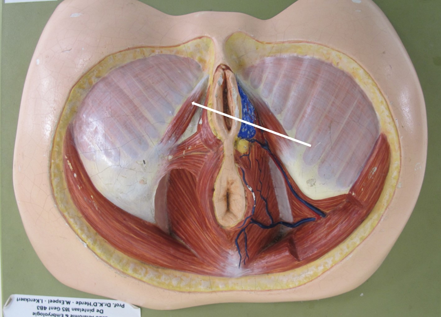 <p><span>zwellichaam van clitoris (onder m. ischiocavernosus)</span></p>