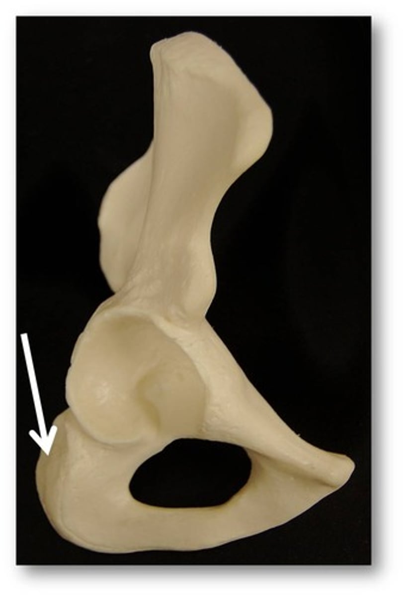 <p>Name this specific part of the ischium.</p>