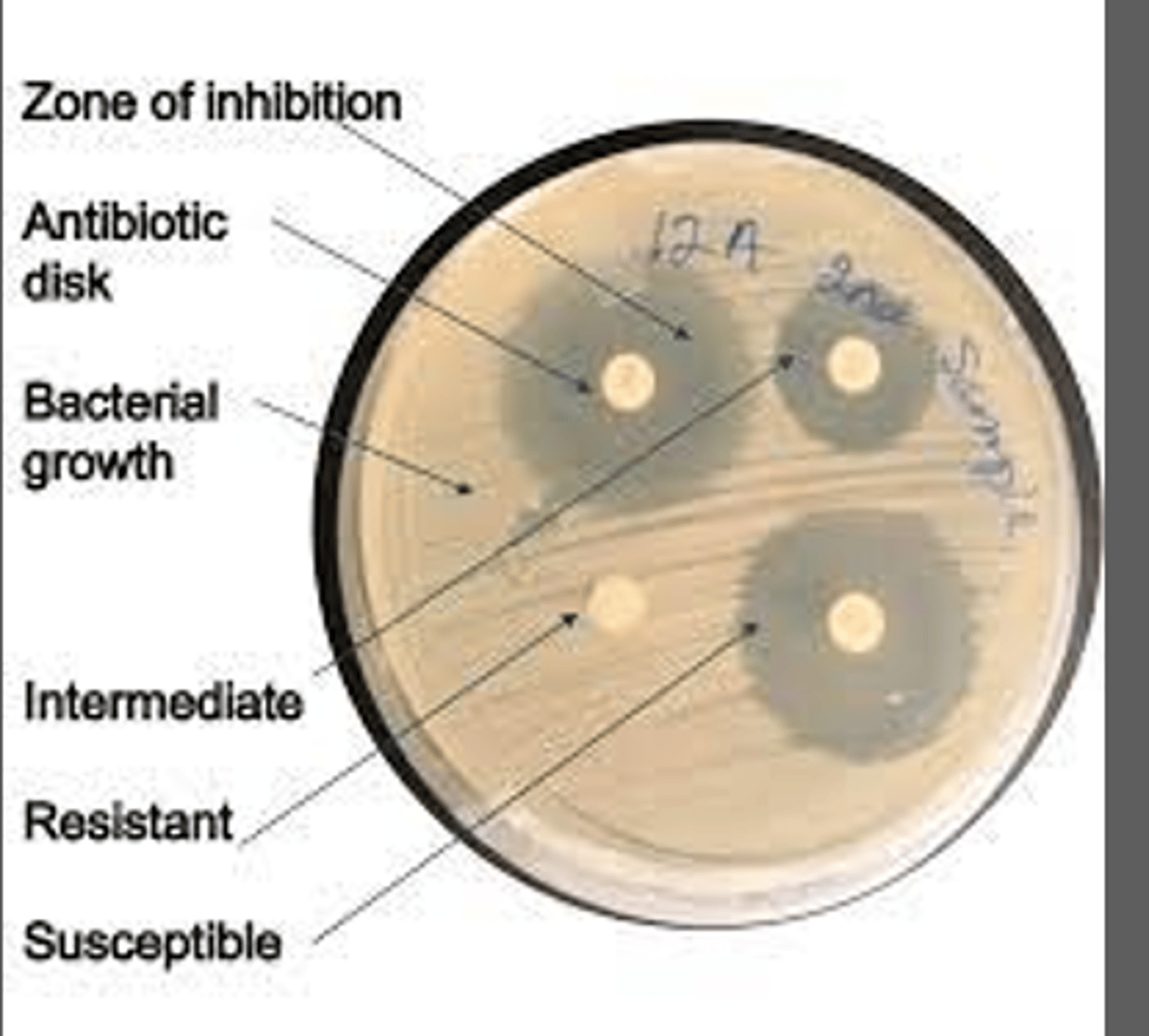 <p>Susceptible: Organism is susceptible to ordinary doses of the antibiotic</p><p>Intermediate: Organism will likely require higher doses or concentration in tissues to work </p><p>Resistant: infected pt is not likely to respond to therapy w this drug</p>