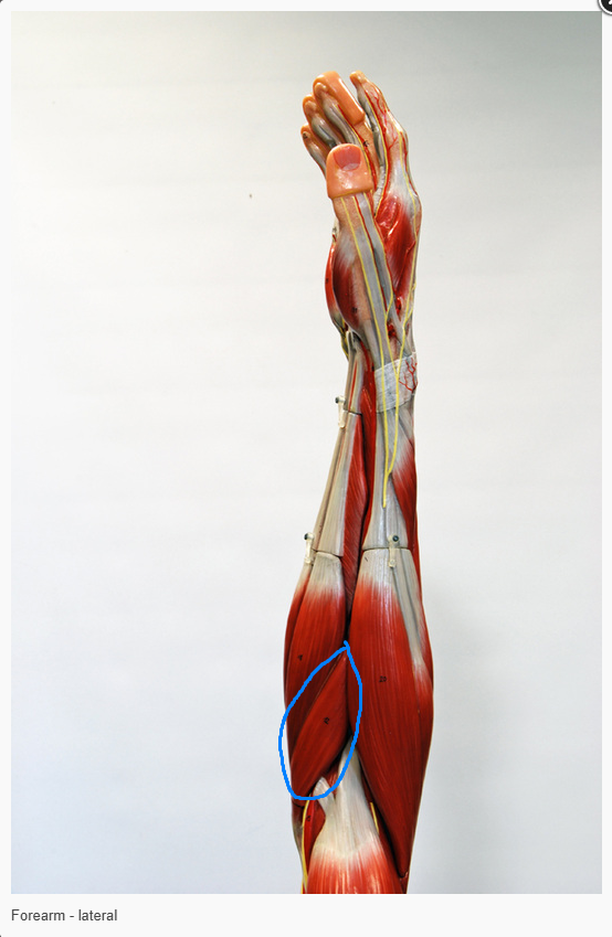 <p>What is the action of the muscle circled </p>