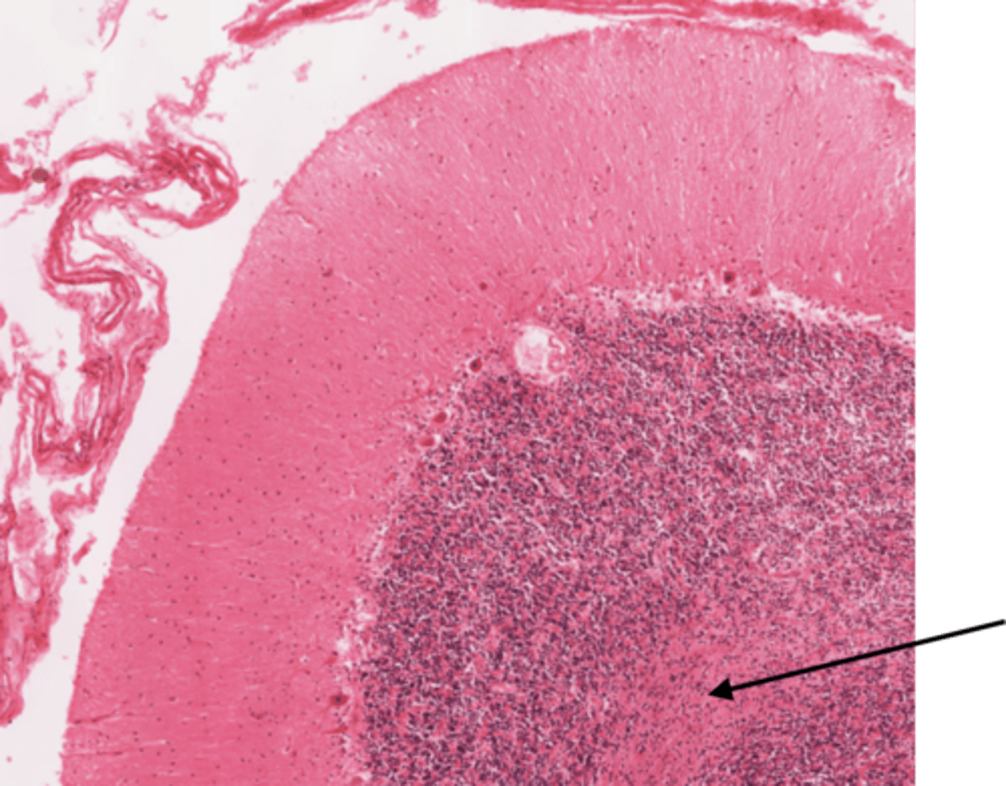 <p>Identify the section of the spinal cord that contains nerve tracts</p>