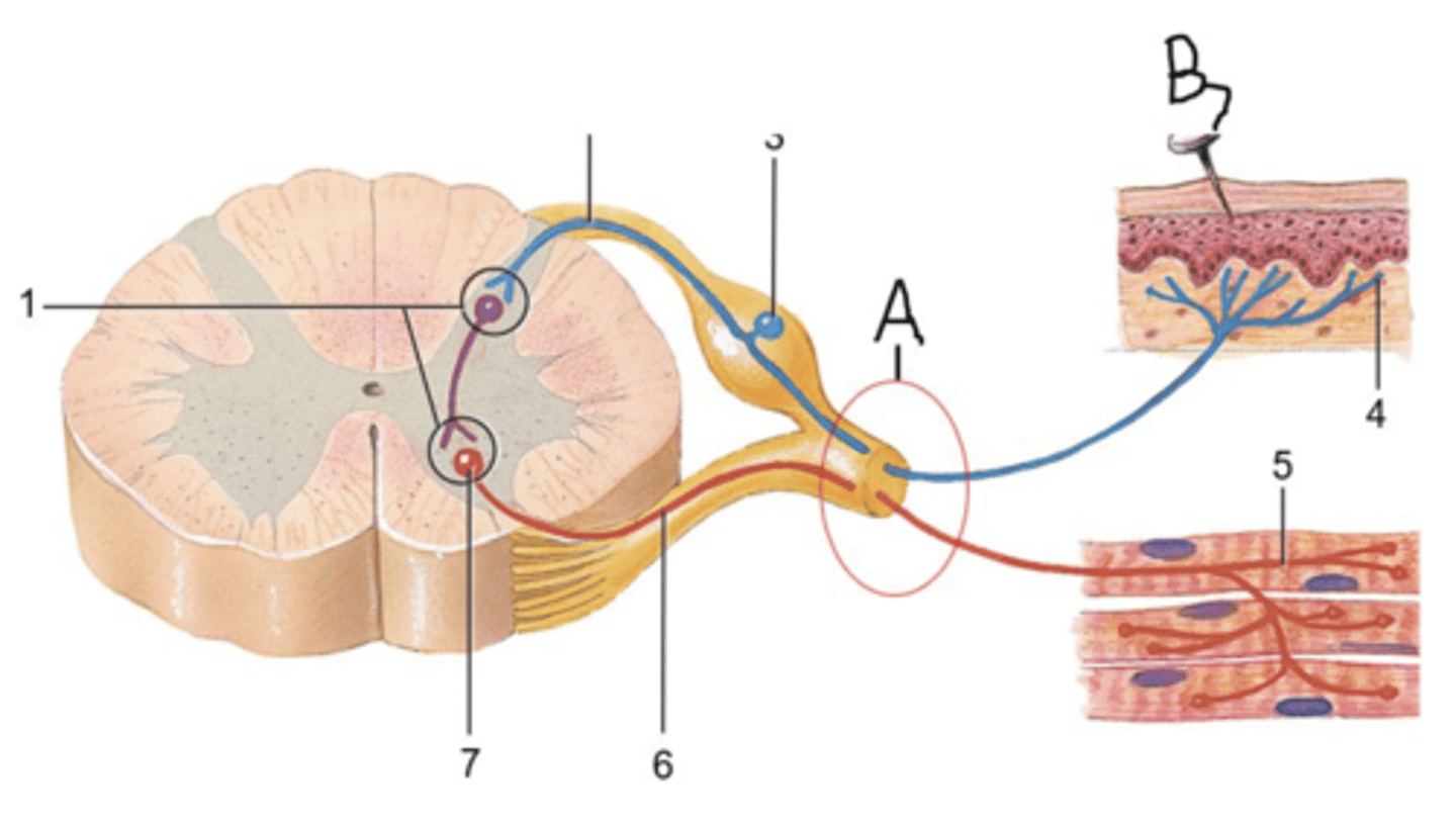 <p>The item labeled B in the picture below represents a stimulus, a painful one at that, causing a reflex action to occur spontaneously. Even though it is a spontaneous, involuntary reaction, it is part of a somatic reflex arc because it results in stimulation of voluntary, skeletal muscle fibers.</p><p>true or false</p>