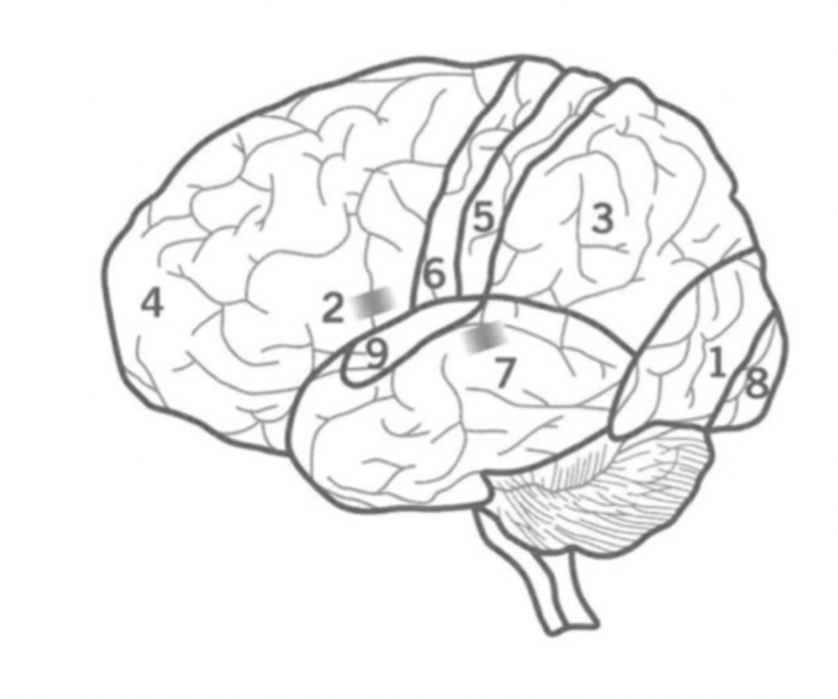 <p>9</p><p>Initial auditory processing.</p><p>located in the Temporal lobe.</p>