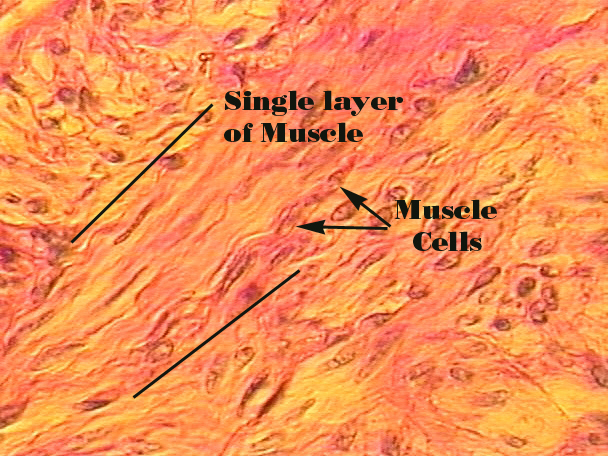 <p>Smooth Muscle </p>