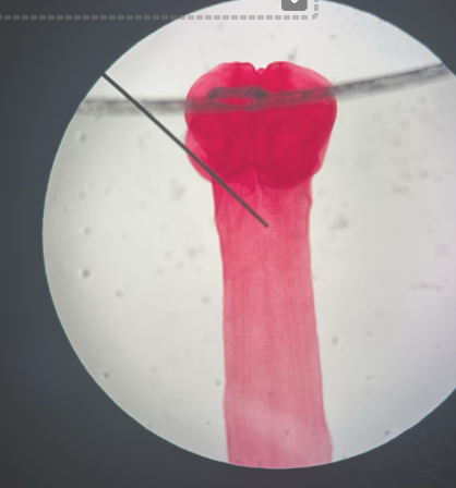 <p>tapeworm head for attachment</p><p><span>Animalia &gt; Platyhelminthes (flatworms) &gt; Cestoda (tapeworms)</span></p>