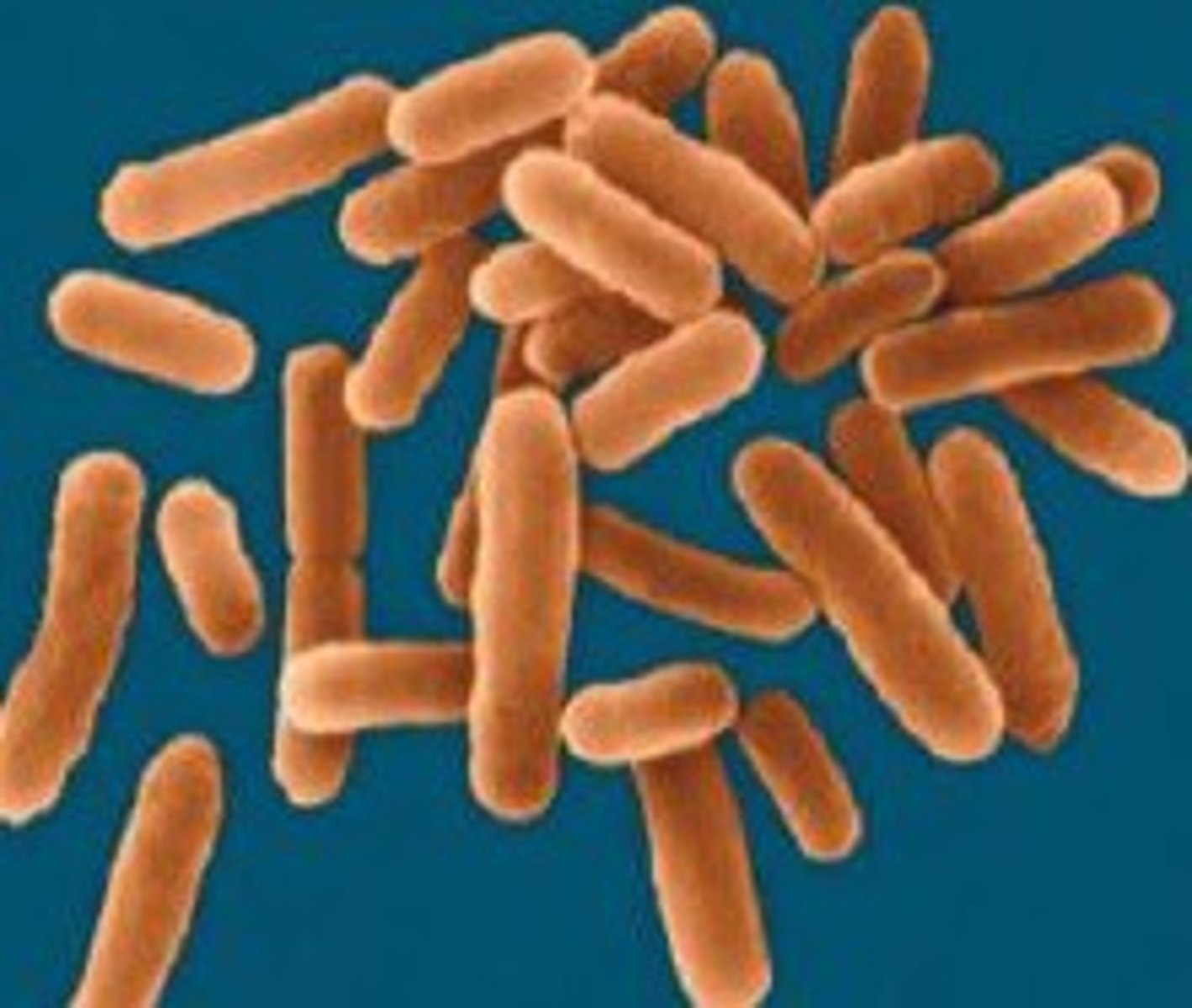 <p>rod-shaped, usually forms chains, may have flagella to move</p><p>ex. E. coli and Salmonella typhi (typhoid fever/food poisoning)</p>