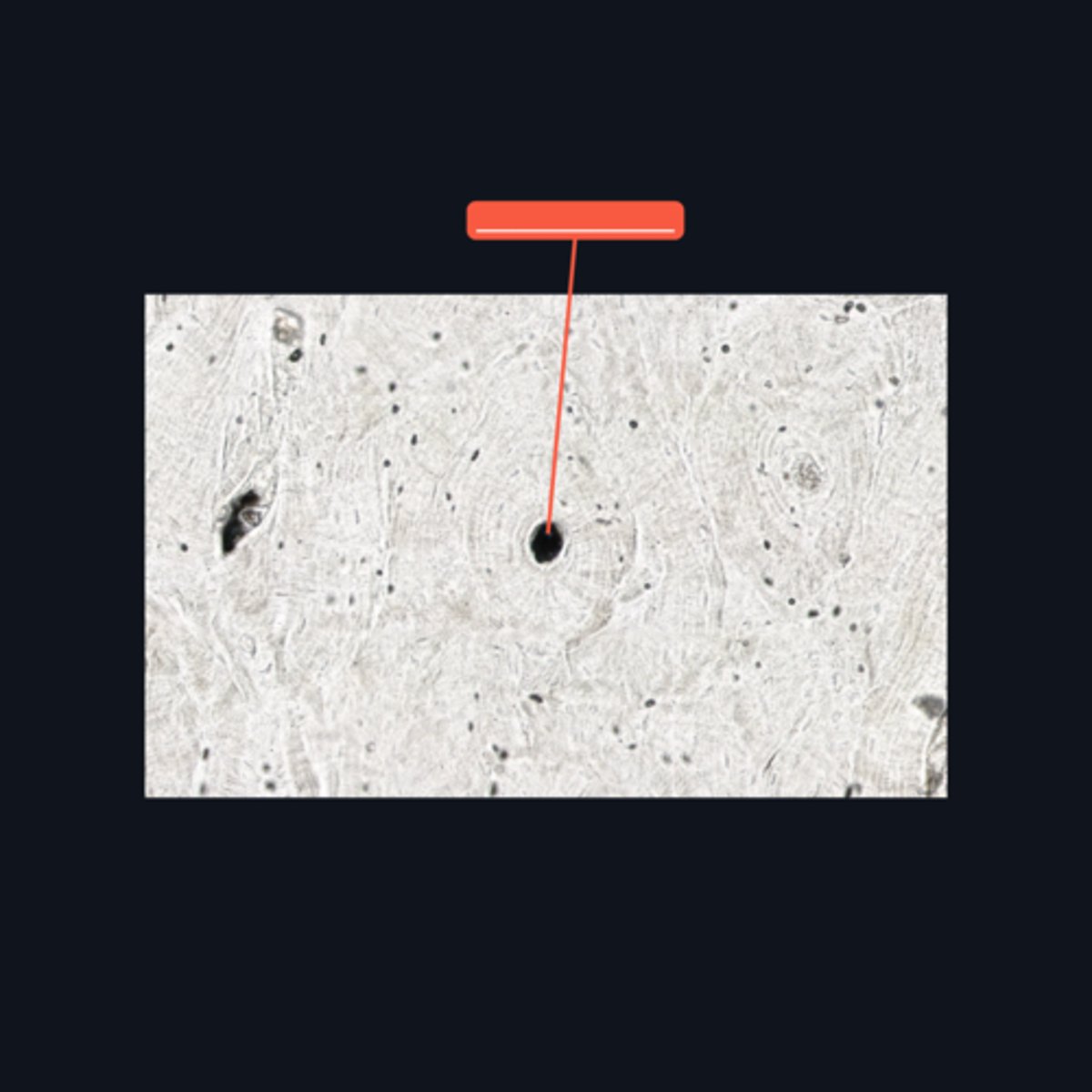 <p>It refers to a longitudinal channel where most of the bone lamellae and their associated osteocytes and lacunae are concentrically arranged</p>