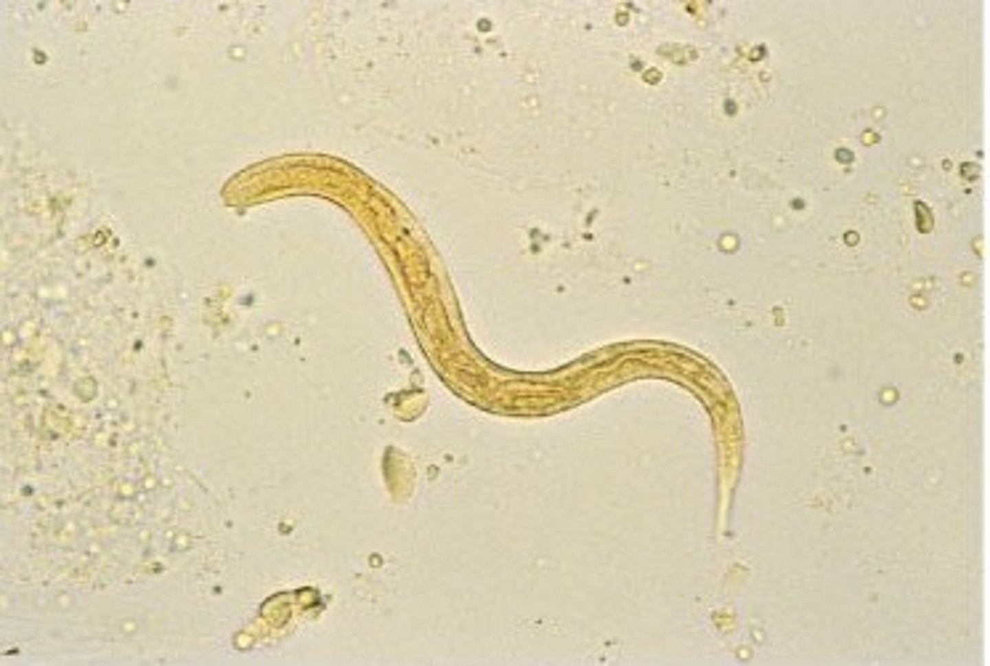 <p>• Worm (rhabditiform larva)</p><p>o Short buccal canal</p><p>o Bulbar portion of</p><p>esophagus</p><p>o Genital primordium</p>