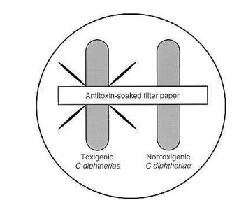 <p>DM biochem!</p><p>ELEK immunoprecipitate test (immunodiffusion)</p>