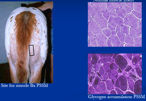 <ul><li><p>Glycogen storage disease </p></li><li><p><span style="background-color: transparent;"><strong><u><span>Type 1 → Young QH &amp; Draft horses</span></u></strong></span></p><ul><li><p><span style="background-color: transparent;"><strong><span>Et: </span></strong></span><span style="background-color: transparent; color: red;"><span>GYS1</span></span><span style="background-color: transparent;"><span> mutation </span></span></p></li><li><p><span style="background-color: transparent;"><strong><span>Cs: </span></strong></span><span style="background-color: transparent; color: red;"><strong><span>recurring</span></strong></span><span style="background-color: transparent;"><span> </span></span><span style="background-color: transparent; color: red;"><strong><span>rhabdomyolysis, draft horse →weakness</span></strong></span></p></li><li><p><span style="background-color: transparent;"><strong><span>Dt:</span></strong><span> </span><strong><u><span>↑ CK</span></u></strong><span>,</span></span><span style="background-color: transparent; color: red;"><span> genetic test</span></span><span style="background-color: transparent;"><span>, </span><u><span>amylase-resistant</span></u><span> glycogen m. biopsy&nbsp;</span></span></p></li><li><p><span style="background-color: transparent;"><strong><span>Tx:</span></strong><span>&nbsp; </span><strong><u><span>↑ </span></u></strong><u><span>fat +</span></u><strong><u><span> ↓ </span></u></strong><u><span>low starch diet</span></u><span>, consistent exercise</span></span></p></li></ul></li><li><p><span style="background-color: transparent;"><strong><u><span>Type 2 → Adult/mature warmbloods</span></u></strong></span></p><ul><li><p><span style="background-color: transparent;"><strong><span>Et: </span></strong><span>unknown </span></span></p></li><li><p><span style="background-color: transparent;"><strong><span>Cs:</span></strong><span> </span></span><span style="background-color: transparent; color: red;"><strong><span>chronic stiffness</span></strong></span><span style="background-color: transparent;"><strong><span>, exercise intolerance, gait abnormalities, gradual muscle loss&nbsp;</span></strong></span></p></li><li><p><span style="background-color: transparent;"><strong><span>Dt: breed &amp; history,</span></strong><span> </span><strong><u><span>↑ </span></u></strong><u><span>CK</span></u></span></p><ul><li><p><span style="background-color: transparent;"><strong><u><span>Type 1</span></u></strong><u><span>: genetic test</span></u></span></p></li><li><p><span style="background-color: transparent;"><strong><u><span>Type 2:</span></u></strong><u><span> muscle biopsy→ amylase-sensitive glycogen</span></u></span></p></li></ul></li><li><p><span style="background-color: transparent;"><strong><span>Tx:</span></strong><span>&nbsp; </span><strong><u><span>↑ fat + ↓ low starch</span></u></strong><u><span> </span></u></span><span style="background-color: transparent; color: red;"><u><span>diet</span></u></span><span style="background-color: transparent;"><span>, consistent </span></span><span style="background-color: transparent; color: red;"><span>exercise</span></span></p></li></ul></li></ul><p></p>