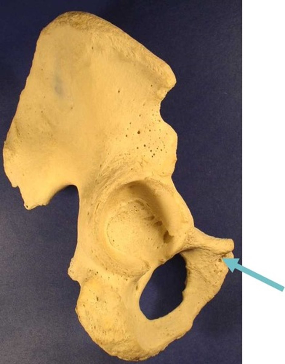 <p>ID bone</p>
