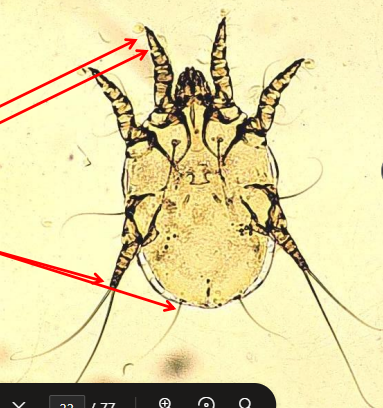 <ul><li><p>Ectopic infestations </p></li><li><p><span style="color: rgb(136, 136, 136);"><strong>Et: </strong></span>Obligate, non-burrowing, cats, dogs, foxes, humans&nbsp;</p><ul><li><p>deep  in ear, near ear drum</p></li></ul></li><li><p><span style="color: rgb(136, 136, 136);"><strong>Id:</strong></span><strong> </strong><u>short unjointed pedicles, whip setae on hind legs</u> (F), transverse genital opening (F) →<strong> 6 legged larva, adult 8 legs (males) / females 6 legs</strong></p></li><li><p><span style="color: rgb(136, 136, 136);"><strong>Cs:</strong></span> <strong>bilateral otitis externa</strong>, <strong>dark brown ceruminous, head shaking, scratching ears, hematomas, circling, convulsions</strong></p></li><li><p><span style="color: rgb(136, 136, 136);"><strong>Dt:</strong> </span>direct otoscopy, microscopy</p></li><li><p><span style="color: rgb(136, 136, 136);"><strong>Tx: </strong></span>clean ears, treat all, tresaderm drops, ivermectin, Fipronil, Selamectin, Advantage-multi</p></li></ul><p></p>