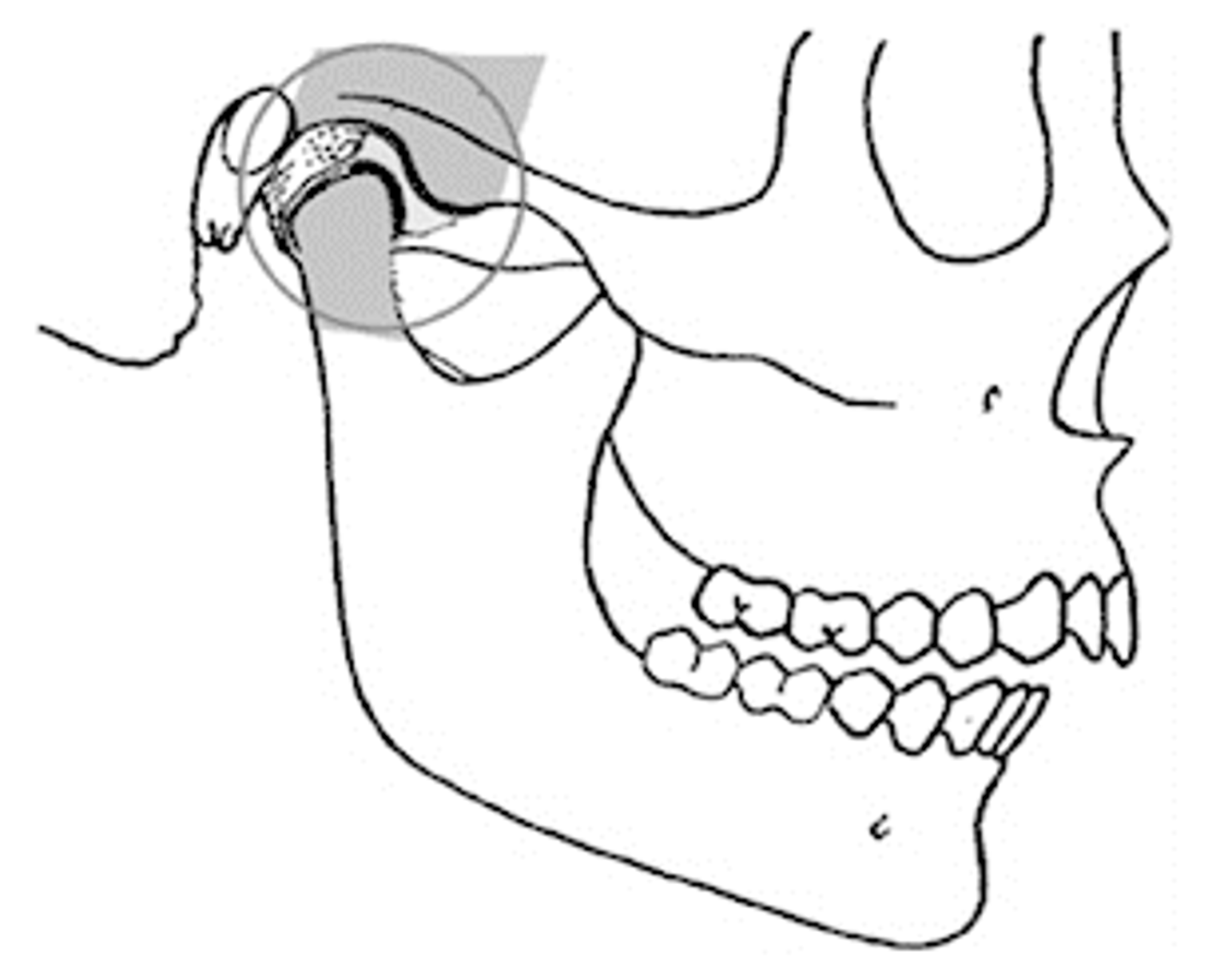 <p>maxillomandibular relationship where the functional heads of the condyles are in the most unrestrained, retruded anatomic position in the glenoid fossae of the temporomandibular joints</p>