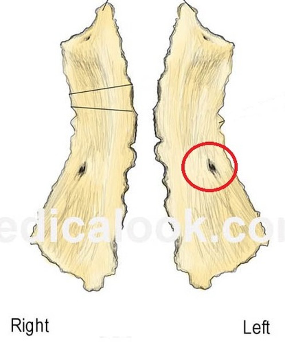 <p>what feature is this on nasal bone?</p>