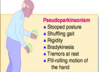 <p>Pseudoparkinsonism</p>