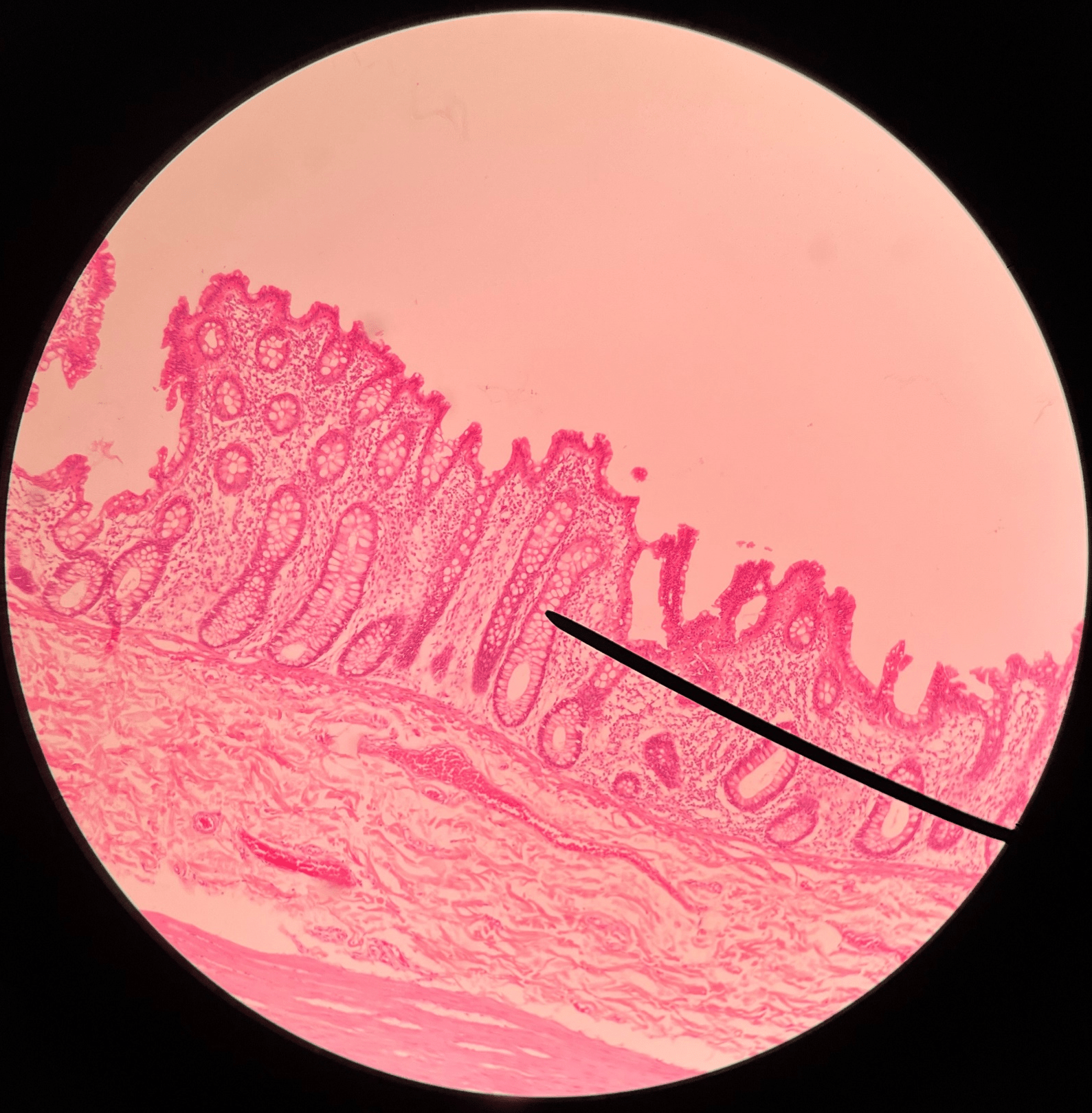 • Slide histology of the large intestine.

• Secretes mucus.