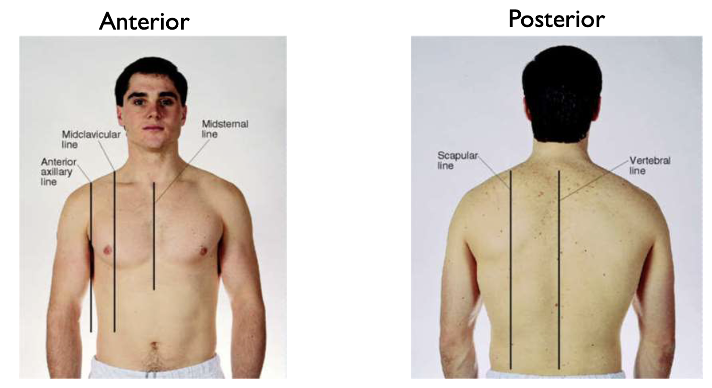 <p>Anterior Axillary Line, Midclavicular line, midsternal line, scapular line, vertebral line</p>