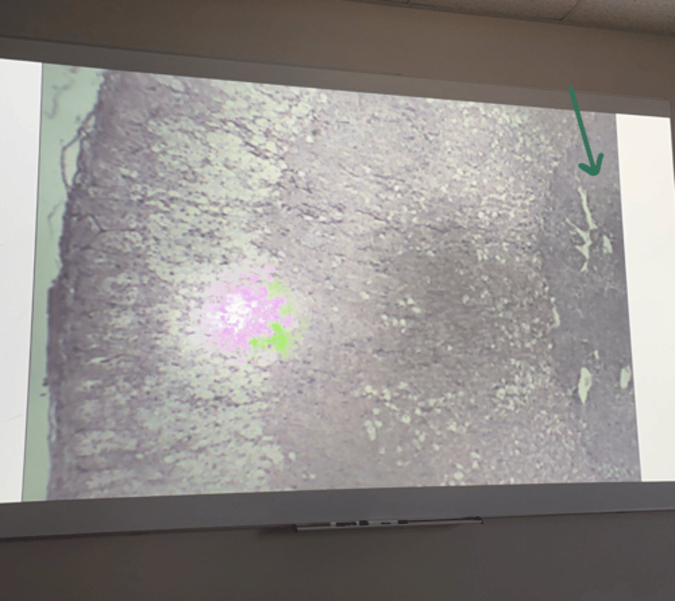 <p>gland and structure</p>