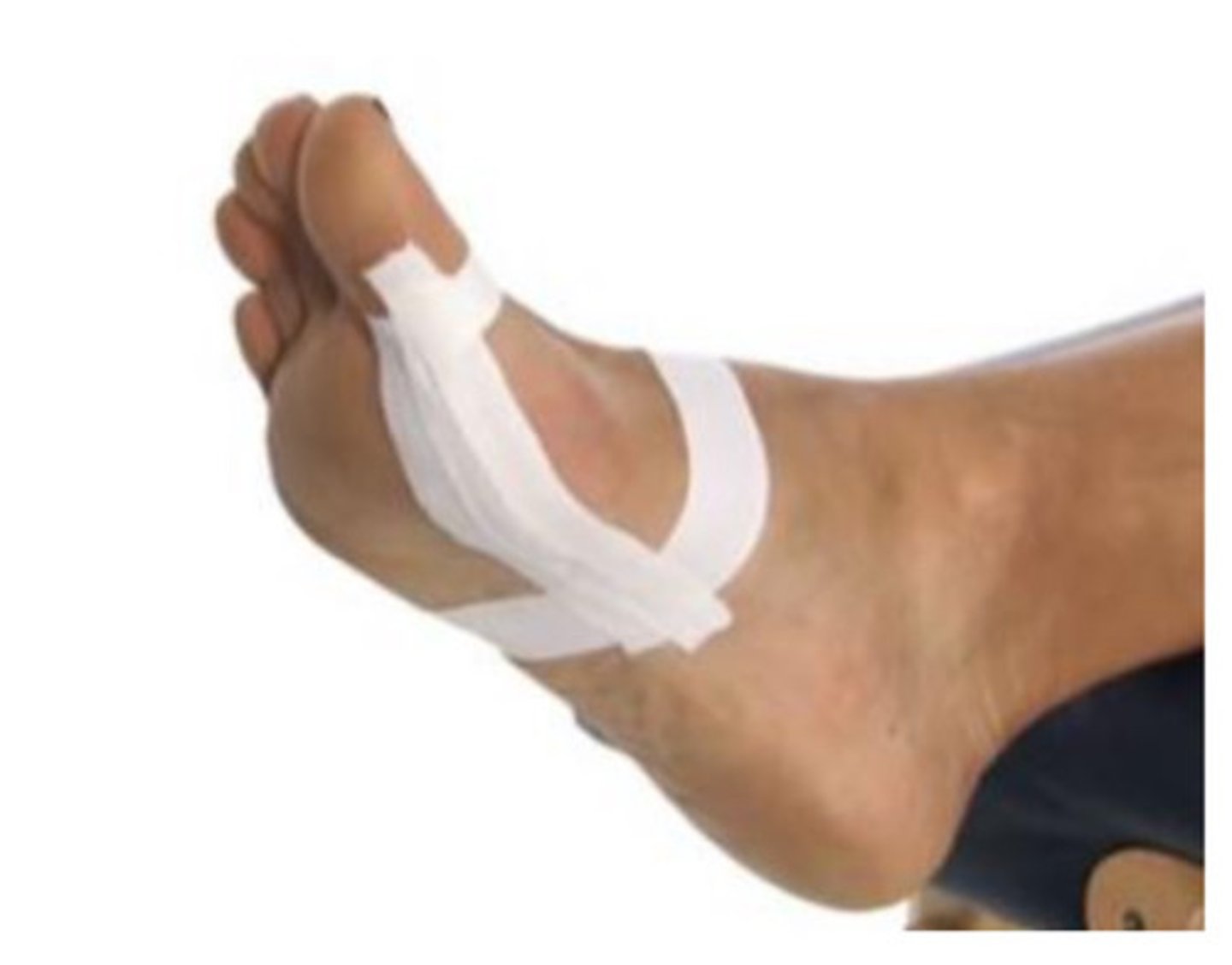 <p>Goal: restrict the extension of the great toe.</p>