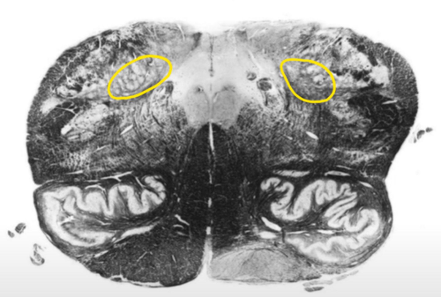 <p>ID the nucleus</p>