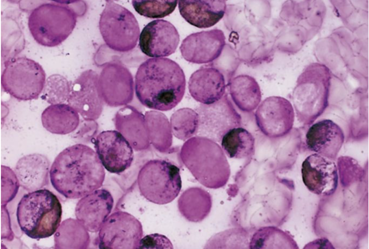 <ul><li><p>Non-enzyme reaction which stains <strong>intracellular lipids</strong></p></li><li><p> Also stains neutral fats and phospholipids</p></li><li><p> SBB most sensitive for granulocytic precursors</p></li><li><p> More stable</p><ul><li><p> Because it doesn't depend on enzymes</p></li><li><p><strong> Particularly useful for specimens that aren’t fresh</strong></p></li></ul></li><li><p> Closely parallels myeloperoxidase (MPO)</p></li></ul><p></p>
