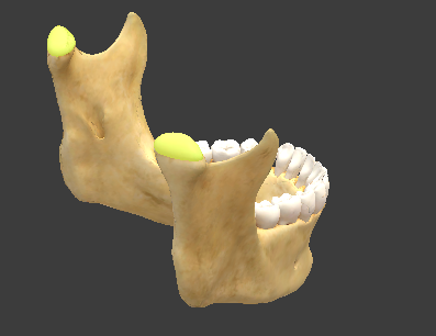 term image