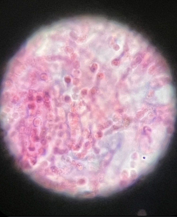 <p>What is the organism and is it prokaryotic or eukaryotic? Say if photosynthetic</p>