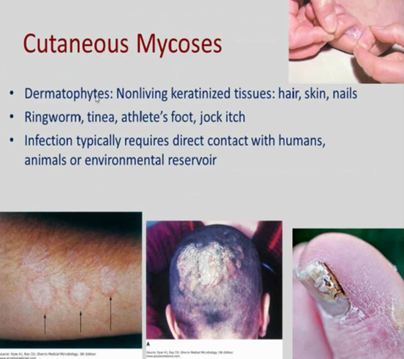 <p>Colonize the hair, nails, and outer epidermis; metabolize keratin</p>