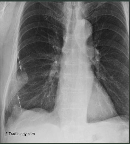 <p>What is the arrow pointing to on this PE?</p>